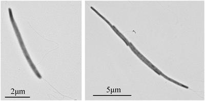 Iocasia fonsfrigidae NS-1 gen. nov., sp. nov., a Novel Deep-Sea Bacterium Possessing Diverse Carbohydrate Metabolic Pathways